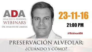 WebinarADA Preservación Alveolar [upl. by Laforge996]