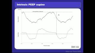 Ventilation in the Obese Patient by Dr Jörg Steier MD D PhD UK [upl. by Chang]