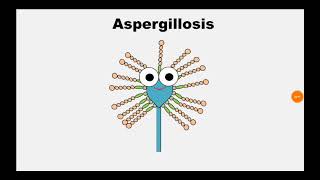 5 Aspergillosis [upl. by Dragelin731]