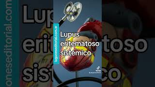 Morbilidad cardiovascular en lupus eritematoso sistémico [upl. by Diantha]