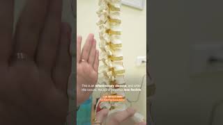 What is Ankylosing Spondylitis [upl. by Prudence278]