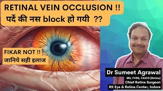 पर्दे की नस block हो जाए Retinal Vein Occlusion तो क्या करें [upl. by Eimmac]