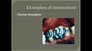 Basic Dental Materials Science [upl. by Grimaud]