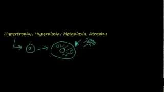 2  Introduction to pathology  hypertrophy hyperplasia [upl. by Romeyn]