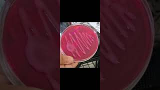 Macconkey agar microbiology macConkeyagar microbiology agar [upl. by Batchelor]