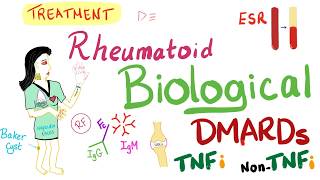 Rheumatoid Arthritis RA  Management  DMARDs  TNF  Rheumatology Series [upl. by Derej]