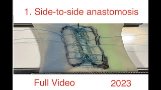 Sidetoside bowel anastomosis 2023 extended [upl. by Ralat]