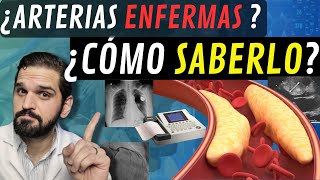 INTERESANTE¡ Exámenes para saber SI TENGO las ARTERIAS del corazón ENFERMAS 😲 [upl. by Eissalc766]