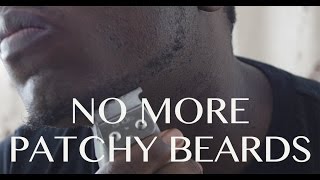 How to Fill in Your Patchy Beard [upl. by Ivetts]