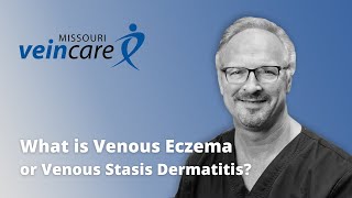 What is Venous Eczema [upl. by Alyos]