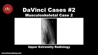 Upper Extremity Radiology Case DaVinciCases Musculoskeletal 2 [upl. by Amled513]