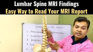 Lower Back MRI Learn to Read Your MRI report Slipped Disc MRI Lumbar Spine MRI Easy MRI reading [upl. by Siclari]