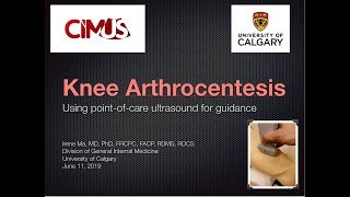 US Guided Knee Arthrocentesis [upl. by Pike]