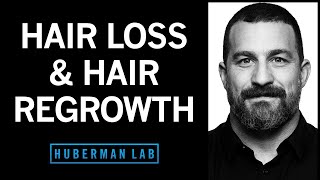 The Science of Healthy Hair Hair Loss and How to Regrow Hair  Huberman Lab Podcast [upl. by Marzi275]