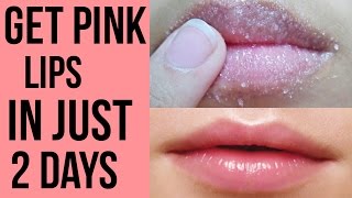 How to get pink lips Lighten dark lips naturally at home Get Rid Of Chapped Lips [upl. by Enrobialc]