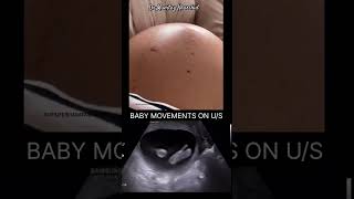 9 Months Pregnancy Baby Movement [upl. by Eelesor]