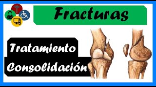 🦴 FRACTURAS  Tipos CONSOLIDACIÓN y TRATAMIENTO fractures [upl. by Atinob108]