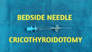 Emergency Needle Cricothyroidotomy [upl. by Materse]