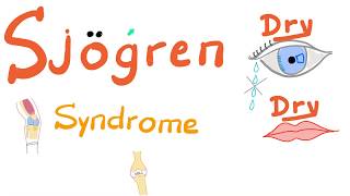 Sjögren Syndrome  Dry eyes Dry mouth Arthritis  Rheumatology Series [upl. by Materse843]