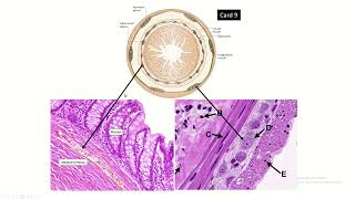 Figure of Enteric Nervous System Plexuses in histology slide of gut [upl. by Aneleh]