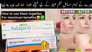 Skinoren Cream amp Adapco Cream Together  Uses benefits without side effects [upl. by Gnol]