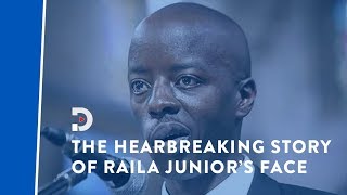 The heartbreaking story of Raila Odinga Juniors medical condition that left him partially paralysed [upl. by Ylloh]