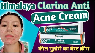 Himalaya Clarina Anti Acne Cream कील मुहांसे को जड़ से खत्म करे। 100 आयुर्वेदिक पिंपल मुहासा क्रीम [upl. by Cirillo]