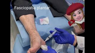 Inyección ecoguiada para fascia plantar [upl. by Ruhtua]