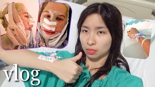 I got plastic surgery to look like Oli London vlog [upl. by Champ501]