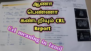 How to Gender prediction using CRL in tamilஆணா பெண்ணா என கண்டறியும் Report [upl. by Sarchet]