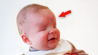 Mum Abandoned Baby Born Without Eyes Then Something Unbelievable Happened To Him [upl. by Sink457]