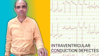 INTRAVENTRICULAR CONDUCTION DEFECTES [upl. by Aitnohs]