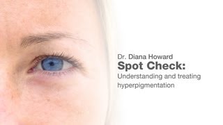 Spot Check Understanding and Treating Hyperpigmentation [upl. by Au]