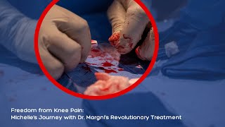 Freedom from Knee Pain Michelle’s Journey with Dr Margnis Revolutionary Treatment [upl. by Sirad]