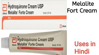 Melalite Forte Cream uses side effects and doses in Hindi [upl. by Hanid]