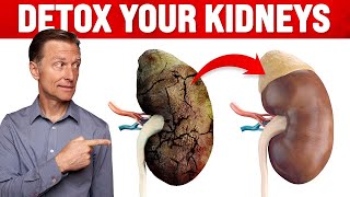 A Surprising Way to Cleanse Toxic Kidneys  Dr Berg on Kidney Detoxification [upl. by Acino]