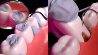 ASMR🦷 1 Hour of Teeth Scaling ⎢ Deep Dental Cleaning ⎢ Dental Pick No Talking [upl. by Luanne]