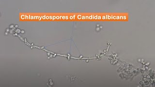 Chlamydospores of Candida albicans observation [upl. by Nirrek717]