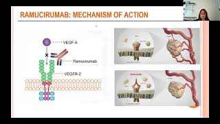 Clinical Trials for Thymic Tumors 2024 Update [upl. by Adah845]