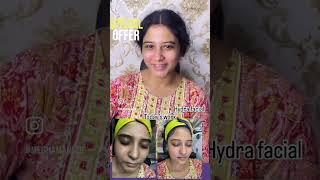 Hydra facial review trending comedy subscribe facial hydrafacial [upl. by Qahsi806]