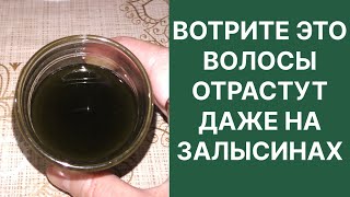 Вотрите Это Волосы Отрастут Даже на Залысинах Рецепт [upl. by Admama]