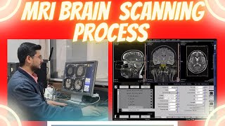 MRI Brain scanning process on siemens 15 tesla machine  MRI BRAIN WITH CISS sequence [upl. by Erialc]