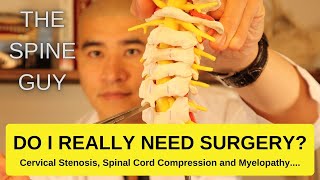 Cervical Stenosis Spinal Cord Compression and Myelopathy DO I REALLY NEED SURGERY [upl. by Hueston373]