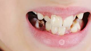 Tooth Sensitivity Causes Solutions sensations pain oralcare enamel dentalproblem [upl. by Ulita]