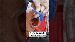 prostodoncia protesisdental dentista protesisdentales protesista doctor [upl. by Davide]