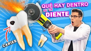 Qué Hay Dentro de un DIENTE con Caries ✂️😬  Curiosidades con Mike [upl. by Annocahs]