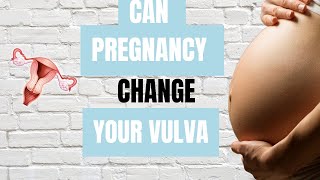 Can Pregnancy Change the Shape Of Your Vulva [upl. by Salohcim]