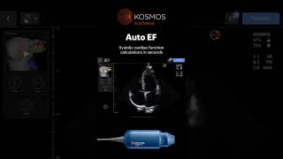 Full Kosmos POCUS Capabilities on Apple iOS [upl. by Teeniv]