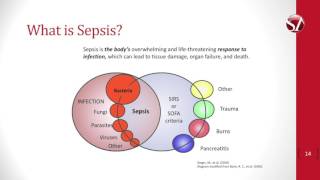 Nurses Suspect Sepsis Educational Video [upl. by Euqinay213]