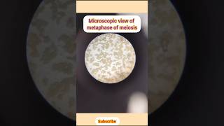 Metaphase of meiosis cell division xii bio  shorts  sa [upl. by Aerol]